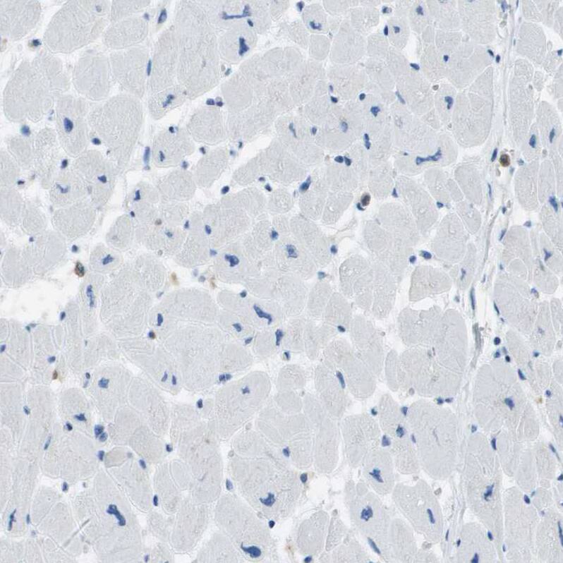 Staining of human heart muscle shows no positivity in cardiomyocytes as expected.