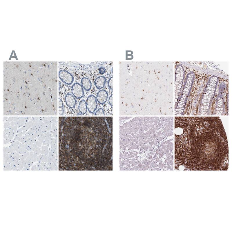 <b>Orthogonal Strategies Validation. </b>Staining of human cerebral cortex, colon, heart muscle and lymph node HPA017009 (A) shows similar protein distribution across tissues to independent antibody HPA063903 (B).
