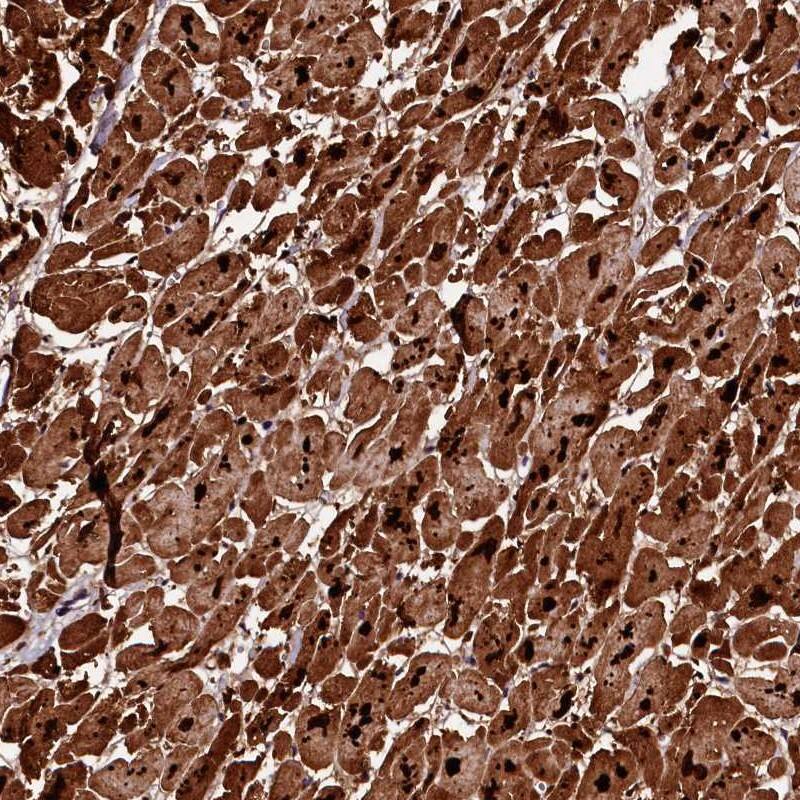 Staining of human heart muscle shows strong cytoplasmic positivity in myocytes.