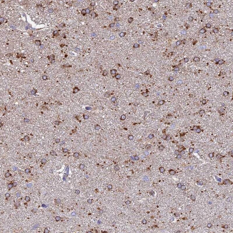 Staining of human cerebral cortex shows strong cytoplasmic positivity in glial cells.