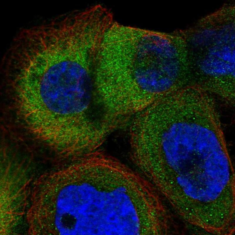 Staining of human cell line A-431 shows localization to cytosol.
