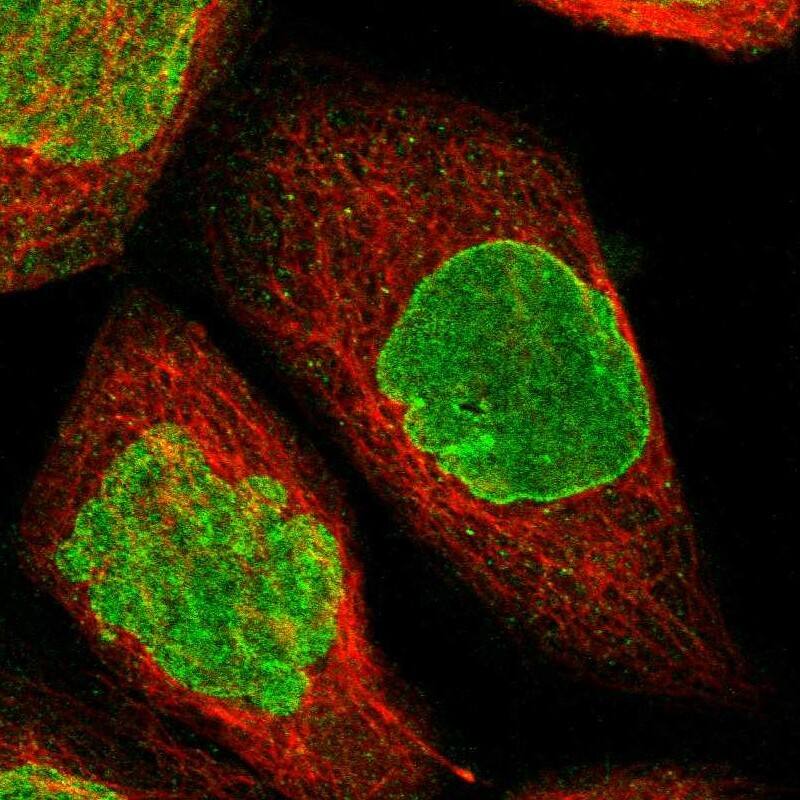 Staining of human cell line A-431 shows positivity in nucleus & nuclear membrane.
