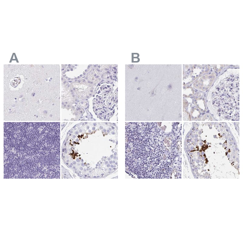 Staining of human cerebral cortex, kidney, lymph node and testis using NBP2-14406 (A) shows similar protein distribution across tissues to independent antibody NBP2-49226 (B).