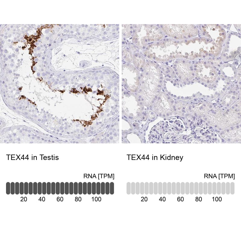 Analysis in human testis and kidney tissues. Corresponding TEX44 RNA-seq data are presented for the same tissues.