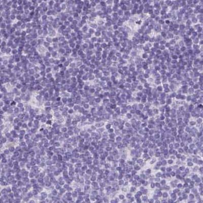 Staining of human lymph node 