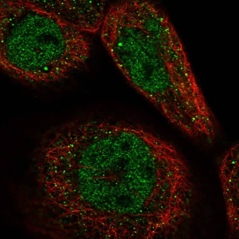 Staining of human cell line A-431 shows localization to nucleoplasm & cytosol.