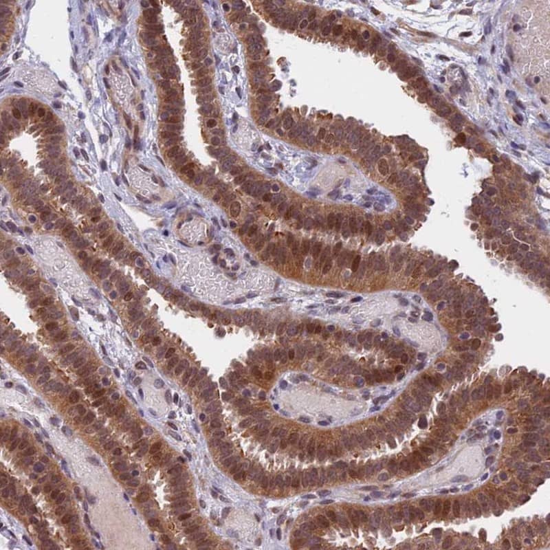 Staining of human fallopian tube shows moderate nuclear and cytoplasmic positivity in glandular cells.