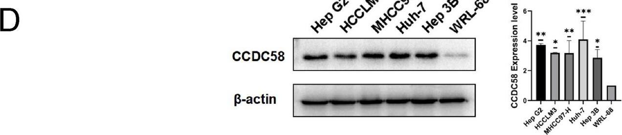 <b>Independent Antibodies Validation. </b>(A) The expression of CCDC58 protein in BRCA, Clear cell RCC, COAD, GBM, LUAD, OV, PAAD and UCEC from CPTAC. (B) Based on individual cancer stage, the expression of CCDC58 protein in BRCA, KIRC, COAD, LUAD, OV, PAAD and UCEC. (C) The expression of CCDC58 protein in tumor and normal tissue of breast, cerebral cortex, colon, kidney, liver and ovary from HPA. (D) The expression of CCDC58 protein in cell lines by western blotting. Image collected and cropped by CiteAb from the following open publication (//www.nature.com/articles/s41598-024-59154-9), licensed under a CC-BY license. Not internally tested by Novus Biologicals.