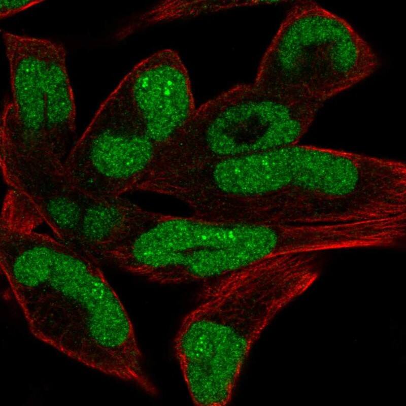 Staining of human cell line RH-30 shows localization to nucleus & nucleoli fibrillar center.
