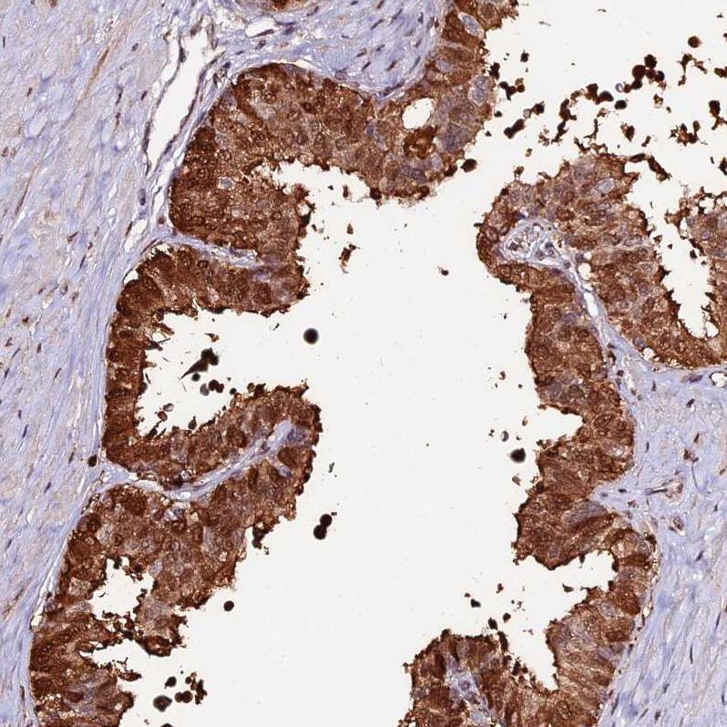 Staining of human prostate shows moderate nuclear and cytoplasmic positivity in glandular cells.