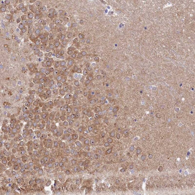 Staining of human hippocampus shows moderate cytoplasmic and nucleolar positivity in neuronal cells.