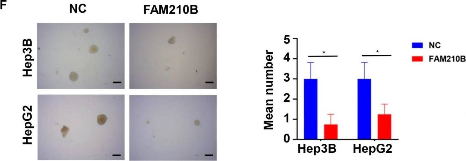 FAM210B inhibited HCC cell growth in vitro. (A) CCK-8 assays were used to assess the FAM210B-deficient Hep3B and HepG2 cell viability once a day for 4 days. (B) Overexpression of FAM210B in Hep3B and HepG2 cells inhibited cell growth, as shown by CCK-8 assays. (C) Clonal expansion analysis was conducted in FAM210B-deficient Hep3B and HepG2 cells. (D) The effects of FAM210B overexpression on the survival cells were examined using colony formation assays. When colonies were stained with crystal violet, they appeared purple. (E) The impacts of FAM210B knockdown on cellular malignant transformation were assessed by soft agar colony formation assay. (Scale bar = 1 mm). (F) The effects of FAM210B overexpression on cellular malignant transformation were assessed by soft agar colony formation assay. *: p < 0.05; **, p < 0.01; ***, p < 0.001. Image collected and cropped by CiteAb from the following open publication (//pubmed.ncbi.nlm.nih.gov/37189851), licensed under a CC-BY license. Not internally tested by Novus Biologicals.