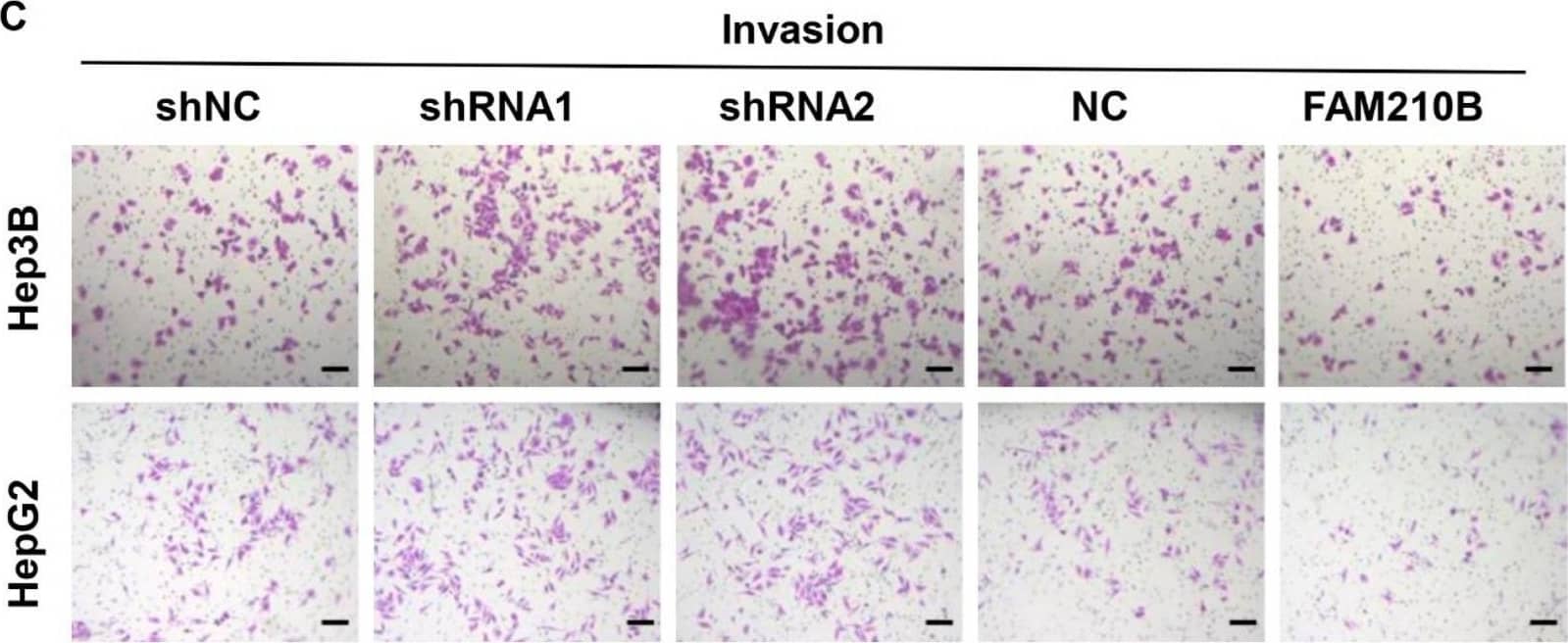 Loss of FAM210B promotes HCC cell metastasis in vitro. (A) The transwell migration assay was conducted in Hep3B and HepG2 cells following transfection with FAM210B shRNA lentivirus or FAM210B overexpression lentivirus. (Scale bar = 200 μm). (B) Statistical graphs of cell transmembrane numbers of the two groups. (C) Stable downregulation of FAM210B expression increased the invasive potential of Hep3B and HepG2 cells in vitro as per Matrigel chamber experiments, but upregulation of FAM210B decreased invasiveness. (Scale bar = 400 μm). (D) Statistical graphs of cell transmembrane number in the two groups. *: p < 0.05; **, p < 0.01; ***, p < 0.001. Image collected and cropped by CiteAb from the following open publication (//pubmed.ncbi.nlm.nih.gov/37189851), licensed under a CC-BY license. Not internally tested by Novus Biologicals.