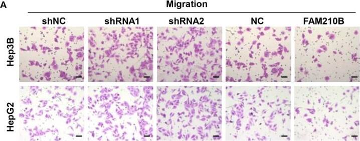 Loss of FAM210B promotes HCC cell metastasis in vitro. (A) The transwell migration assay was conducted in Hep3B and HepG2 cells following transfection with FAM210B shRNA lentivirus or FAM210B overexpression lentivirus. (Scale bar = 200 μm). (B) Statistical graphs of cell transmembrane numbers of the two groups. (C) Stable downregulation of FAM210B expression increased the invasive potential of Hep3B and HepG2 cells in vitro as per Matrigel chamber experiments, but upregulation of FAM210B decreased invasiveness. (Scale bar = 400 μm). (D) Statistical graphs of cell transmembrane number in the two groups. *: p < 0.05; **, p < 0.01; ***, p < 0.001. Image collected and cropped by CiteAb from the following open publication (//pubmed.ncbi.nlm.nih.gov/37189851), licensed under a CC-BY license. Not internally tested by Novus Biologicals.