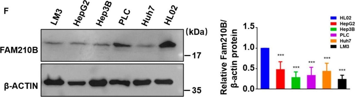 FAM210B was frequently downregulated in HCC. (A) The FAM210B levels were determined in 64 HCC and paired non−tumor paraffin samples by immunohistochemistry (IHC) assays. (B) The levels of FAM210B in HCC and adjoining non-tumor tissues were evaluated by IHC staining (n = 64). (C) IHC staining photos demonstrating FAM210B expression in HCC tumor and adjoining non-tumor samples (scale bar = 400 μm). (D) The overall survival of 64 individuals with HCC–related FAM210B expression was evaluated via the Kaplan–Meier method. p Values were derived through the log-rank test. (E) The levels of FAM210B mRNA were detected in HCC cells and in the hepatic immortal cell line HL02 by qRT−PCR assays. (F) The levels of FAM210B protein were detected by Western blot assays in the HCC cells and hepatic immortal cell line HL02. Quantitative analysis of Western blot is shown. *: p < 0.05; ***, p < 0.001. Image collected and cropped by CiteAb from the following open publication (//pubmed.ncbi.nlm.nih.gov/37189851), licensed under a CC-BY license. Not internally tested by Novus Biologicals.