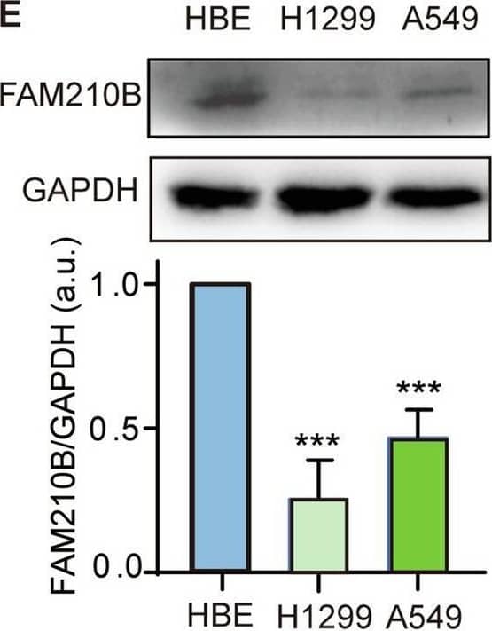 FAM210B expression level was positively correlated with overall survival in LUAD patients.Kaplan-Meier survival analysis of the relationship between FAM210B expression and overall survival in TCGA-LUAD RNA-seq data (A), GSE30219 (B), and GSE31210 (C), with high expression of FAM210B denoted in red and low expression of FAM210B in black. D qRT-PCR was used to analyze the expression levels of FAM210B gene in HBE, H1299, and A549 cell lines. E Western blot analysis of FAM210B protein expression in HBE, H1299, and A549 cell lines (Upper). Quantitative analysis of FAM210B protein expression of three independent repeated experiments (Lower). Data of D-E were represented as mean +/- SEM of three independent experiments. Statistical analysis was performed using Student’s t-test. ***P < 0.001, ****P < 0.0001. Image collected and cropped by CiteAb from the following open publication (//pubmed.ncbi.nlm.nih.gov/39900908), licensed under a CC-BY license. Not internally tested by Novus Biologicals.