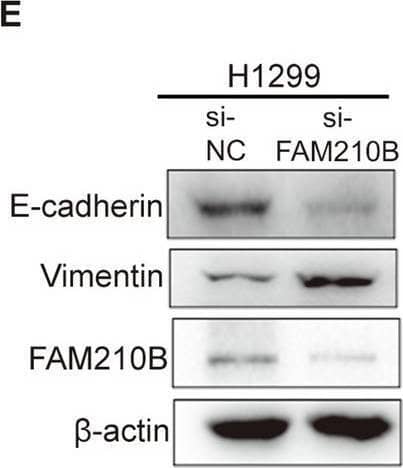 FAM210B suppressed the migration and invasion of LUAD cells in vitro and the tumor metastasis of LUAD tumor in vivo.A, B Transwell assays were conducted to analyze the migration and invasion abilities of H1299 cells or A549 cells transiently (left) or stably (right) overexpressing FAM210B (upper). The quantitative analysis of invasion and migration in H1299 and A549 cells was shown in the lower panels. **P < 0.01, ***P < 0.001 (Student’s t-test). C Transwell assays were performed in FAM210B knocked-down H1299 cells (left). The quantitative analysis of invasion and migration in left panel was shown in the right panel. **P < 0.01, ***P < 0.001 (Student’s t-test). D, E Western blot was performed on H1299 and A549 cells transiently transfected with GFP-FAM210B or FAM210B siRNA to analyze the expression of EMT markers. F Wound healing experiments were conducted on H1299 cells transiently overexpressing GFP-FAM210B and on A549 cells stably overexpressing FAM210B. The quantitative analysis of the scratch width was presented below the corresponding images (mean +/- SEM, n = 3). *P < 0.05 (Student’s t-test). G Representative bioluminescent images of NCG mice acquired 40 days after tail intravenous injection of A549 cells expressing OE-V-Luc or OE-FAM210B-Luc. H Pictures of lungs taken from the indicated groups of nude mice (left), and histological examination of lung tissues using HE staining (right). Scale bar: 100 μm. Image collected and cropped by CiteAb from the following open publication (//pubmed.ncbi.nlm.nih.gov/39900908), licensed under a CC-BY license. Not internally tested by Novus Biologicals.
