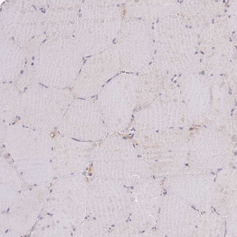 Staining of human Skeletal muscle shows no positivity in myocytes as expected.