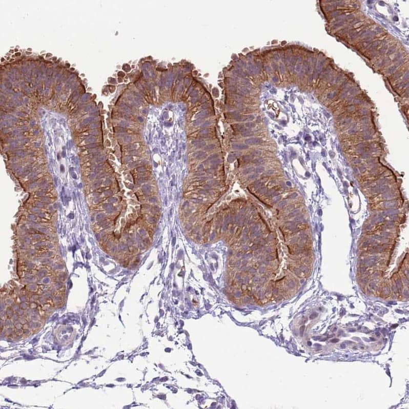 Staining of human Fallopian tube shows strong membranous and cytoplasmic positivity in glandular cells.