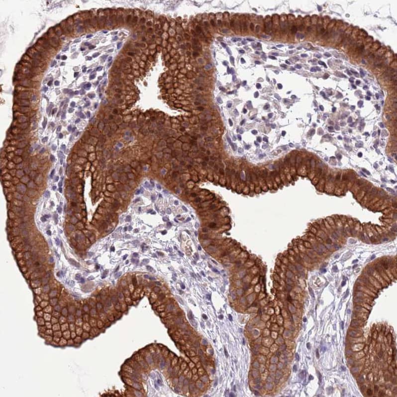 Staining of human Gallbladder shows strong cytoplasmic and membranous positivity in glandular cells.
