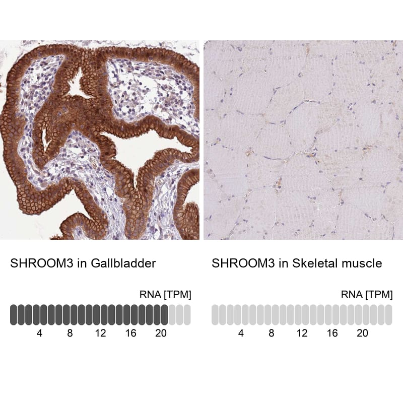 Analysis in human gallbladder and skeletal muscle tissues. Corresponding RNA-seq data are presented for the same tissues.