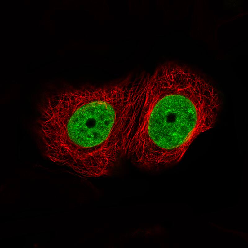 Staining of MCF7 cells, showing specific staining in nucleoplasm in green. Microtubule- and nuclear probes are visualized in red and blue, respectively (where available).