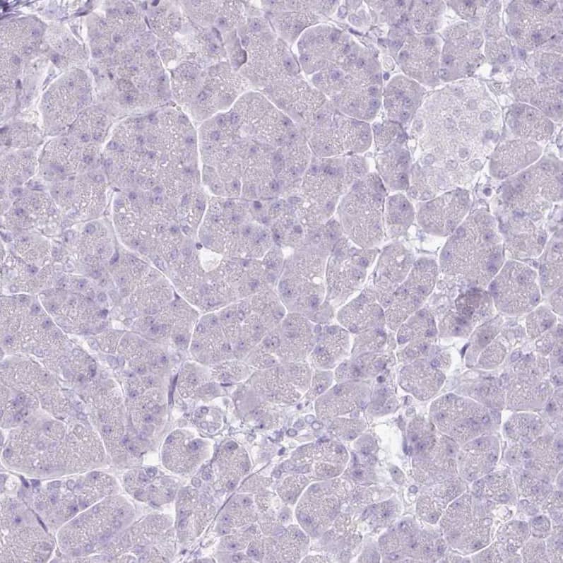 Staining of human pancreas shows no positivity in exocrine glandular cells as expected.