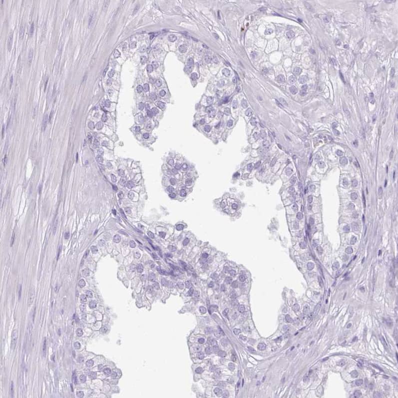 Staining of human prostate shows no positivity in glandular cells as expected.