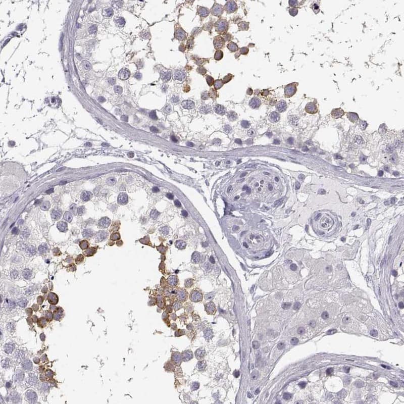 Immunohistochemistry-Paraffin MYCBPAP Antibody - BSA Free