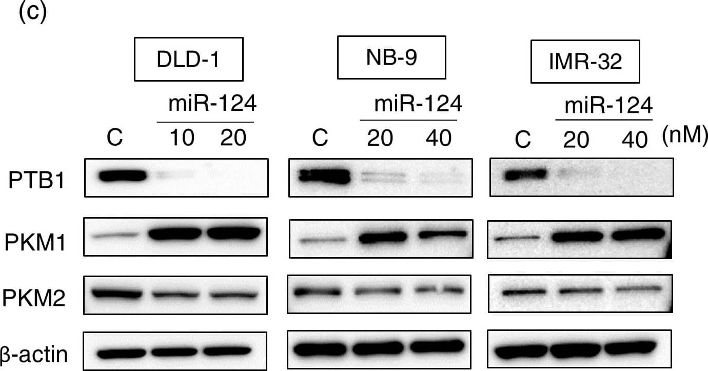 Western Blot: PKM1 Antibody - BSA Free [NBP2-14833] - (a) Luciferase activities after co-transfection of DLD-1 cells w/ control or miR-124 (wild-type or mutant-type) pMIR vectors having predictive miR-124 binding site in 3′UTR of PTB1. Upper panel region of 3′-UTR of human PTB1 mRNA complementary to mature miR-124. Box indicates predicted binding sites for miR-124. (b) Same as “a” except miR-133b used. (c) Expression of PTB1, PKM1, & PKM2 proteins at 72 h after transfection of DLD-1, NB9 or IMR-32 cells w/ miR-124 (10, 20 or 40 nM). (d) Expression of PTB1, PKM1, & PKM2 proteins at 72 h after transfection of DLD-1, RD or KYM-1 cells w/ miR-133b (10, 20 nM). (e) Expression of PTB1, PKM1, & PKM2 proteins at 72 h after transfection of DLD-1, NB-9 or RD cells w/ siR-PTB1 (2, 5 nM). (f) Effect of combined treatment of DLD-1 cells w/ antagomiR-124 & miR-124 or antagomiR-133b & miR-133b. DLD-1 cells transfected w/ non-specific control, miR-124/miR-133b (10 nM), miR-124/miR-133b (10 nM) + antagomiR-124/antagomiR-133b (5 nM) or miR-124/miR-133b (10 nM) + antagomiR-124/antagomiR-133b (10 nM). Expression level of PTB1 assessed at 48 h after transfection. The full-length blots are presented in Supplementary Figure S3a. (g) IF of PKM1 (upper panels) & PKM2 (lower panels) at 48 h after transfection of DLD-1 cells w/ miR-124 (20 nM) or miR-133b (20 nM). Left panels, treatment w/ control miRNA; middle panels, treatment w/ miR-124; right panels, treatment w/ miR-133b. PKM1 or PKM2 is stained red, & nuclei are stained blue. (h) Lactate production measured at 48 h after transfection of DLD-1 cells w/ miR-124 (20 nM), miR-133b (20 nM) or siR-PTB1 (5 nM). Results are presented as mean± SD (* P < 0.05; ** P < 0.01; *** P < 0.001; N.S., not statistically significant). Image collected & cropped by CiteAb from the following publication (//www.nature.com/articles/srep08647), licensed under a CC-BY license. Not internally tested by Novus Biologicals.