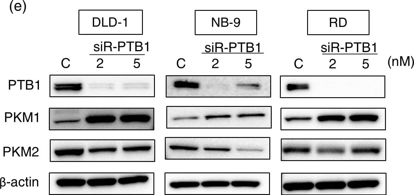 Western Blot: PKM1 Antibody - BSA Free [NBP2-14833] - (a) Luciferase activities after co-transfection of DLD-1 cells w/ control or miR-124 (wild-type or mutant-type) pMIR vectors having predictive miR-124 binding site in 3′UTR of PTB1. Upper panel region of 3′-UTR of human PTB1 mRNA complementary to mature miR-124. Box indicates predicted binding sites for miR-124. (b) Same as “a” except miR-133b used. (c) Expression of PTB1, PKM1, & PKM2 proteins at 72 h after transfection of DLD-1, NB9 or IMR-32 cells w/ miR-124 (10, 20 or 40 nM). (d) Expression of PTB1, PKM1, & PKM2 proteins at 72 h after transfection of DLD-1, RD or KYM-1 cells w/ miR-133b (10, 20 nM). (e) Expression of PTB1, PKM1, & PKM2 proteins at 72 h after transfection of DLD-1, NB-9 or RD cells w/ siR-PTB1 (2, 5 nM). (f) Effect of combined treatment of DLD-1 cells w/ antagomiR-124 & miR-124 or antagomiR-133b & miR-133b. DLD-1 cells transfected w/ non-specific control, miR-124/miR-133b (10 nM), miR-124/miR-133b (10 nM) + antagomiR-124/antagomiR-133b (5 nM) or miR-124/miR-133b (10 nM) + antagomiR-124/antagomiR-133b (10 nM). Expression level of PTB1 assessed at 48 h after transfection. The full-length blots are presented in Supplementary Figure S3a. (g) IF of PKM1 (upper panels) & PKM2 (lower panels) at 48 h after transfection of DLD-1 cells w/ miR-124 (20 nM) or miR-133b (20 nM). Left panels, treatment w/ control miRNA; middle panels, treatment w/ miR-124; right panels, treatment w/ miR-133b. PKM1 or PKM2 is stained red, & nuclei are stained blue. (h) Lactate production measured at 48 h after transfection of DLD-1 cells w/ miR-124 (20 nM), miR-133b (20 nM) or siR-PTB1 (5 nM). Results are presented as mean± SD (* P < 0.05; ** P < 0.01; *** P < 0.001; N.S., not statistically significant). Image collected & cropped by CiteAb from the following publication (//www.nature.com/articles/srep08647), licensed under a CC-BY license. Not internally tested by Novus Biologicals.