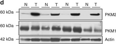 Western Blot: PKM1 Antibody - BSA Free [NBP2-14833] - Characterization of NOX4 & PKM2 in human RCC tumors & adjacent tissue. a Mitochondrial fractions were prepared from human tumors (T) or uninvolved adjacent tissue (N). NOX4 expression was examined by western blot analysis. Prohibitin was probed as a mitochondrial marker & loading control. b Quantitation of NOX4 distribution in the mitochondrial fraction from a. The results are expressed as the means using one-way ANOVA with Tukey’s post hoc test where ± S.E.M. *p < 0.05 compared to normal (N). c Mitochondria fractions were prepared from RCC tumors & NADPH-dependent superoxide generation was examined in the presence (+) or absence (−) of ATP. The results are from eight tumors & are expressed as the means using one-way ANOVA with Tukey’s post hoc test where ±S.E.M. **p < 0.01 is compared to without (−) ATP. d PKM2 & PKM1 expression was examined by western blot analysis in lysates prepared from human tumors (T) or uninvolved adjacent tissue (N) from the same patient. Actin as loading control Image collected & cropped by CiteAb from the following publication (//pubmed.ncbi.nlm.nih.gov/29051480), licensed under a CC-BY license. Not internally tested by Novus Biologicals.