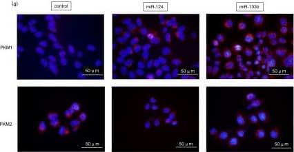 Immunocytochemistry/ Immunofluorescence: PKM1 Antibody - BSA Free [NBP2-14833] - (a) Luciferase activities after co-transfection of DLD-1 cells w/ control or miR-124 (wild-type or mutant-type) pMIR vectors having predictive miR-124 binding site in 3′UTR of PTB1. Upper panel region of 3′-UTR of human PTB1 mRNA complementary to mature miR-124. Box indicates predicted binding sites for miR-124. (b) Same as “a” except miR-133b used. (c) Expression of PTB1, PKM1, & PKM2 proteins at 72 h after transfection of DLD-1, NB9 or IMR-32 cells w/ miR-124 (10, 20 or 40 nM). (d) Expression of PTB1, PKM1, & PKM2 proteins at 72 h after transfection of DLD-1, RD or KYM-1 cells w/ miR-133b (10, 20 nM). (e) Expression of PTB1, PKM1, & PKM2 proteins at 72 h after transfection of DLD-1, NB-9 or RD cells w/ siR-PTB1 (2, 5 nM). (f) Effect of combined treatment of DLD-1 cells w/ antagomiR-124 & miR-124 or antagomiR-133b & miR-133b. DLD-1 cells transfected w/ non-specific control, miR-124/miR-133b (10 nM), miR-124/miR-133b (10 nM) + antagomiR-124/antagomiR-133b (5 nM) or miR-124/miR-133b (10 nM) + antagomiR-124/antagomiR-133b (10 nM). Expression level of PTB1 assessed at 48 h after transfection. The full-length blots are presented in Supplementary Figure S3a. (g) IF of PKM1 (upper panels) & PKM2 (lower panels) at 48 h after transfection of DLD-1 cells w/ miR-124 (20 nM) or miR-133b (20 nM). Left panels, treatment w/ control miRNA; middle panels, treatment w/ miR-124; right panels, treatment w/ miR-133b. PKM1 or PKM2 is stained red, & nuclei are stained blue. (h) Lactate production measured at 48 h after transfection of DLD-1 cells w/ miR-124 (20 nM), miR-133b (20 nM) or siR-PTB1 (5 nM). Results are presented as mean± SD (* P < 0.05; ** P < 0.01; *** P < 0.001; N.S., not statistically significant). Image collected & cropped by CiteAb from the following publication (//www.nature.com/articles/srep08647), licensed under a CC-BY license. Not internally tested by Novus Biologicals.