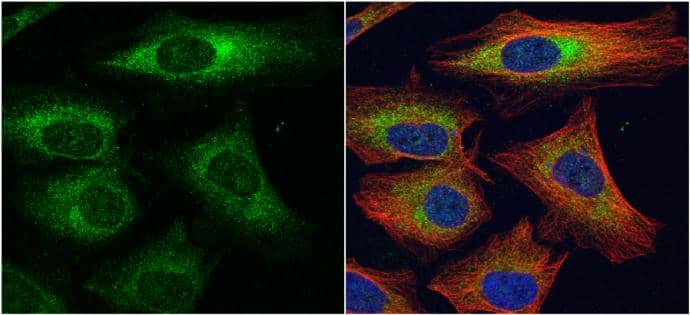 Immunocytochemistry/ Immunofluorescence Dystroglycan Antibody - BSA Free