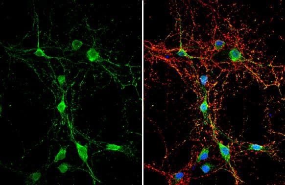 Immunocytochemistry/ Immunofluorescence Dystroglycan Antibody - BSA Free