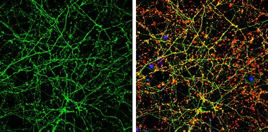 Immunocytochemistry/ Immunofluorescence Calmodulin 2 Antibody - BSA Free