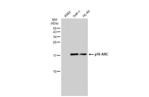 Various whole cell extracts (30 ug) were separated by 15% SDS-PAGE, and the membrane was blotted with p16 ARC antibody (NBP2-14878) diluted at 1:500. The HRP-conjugated anti-rabbit IgG antibody  was used to detect the primary antibody. 