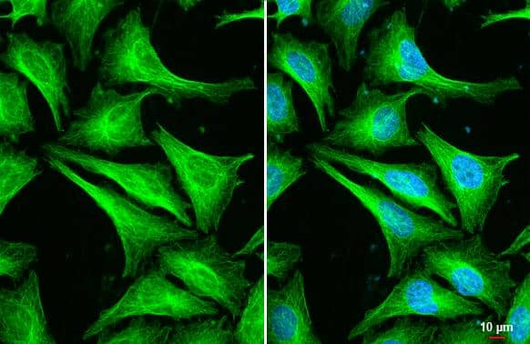 beta Tubulin 2C antibody [C1C3] detects beta Tubulin 2C protein at cytoskeleton by immunofluorescent analysis.Sample: HeLa cells were fixed in 4% paraformaldehyde at RT for 15 min.Green: beta Tubulin 2C stained by beta Tubulin 2C antibody [C1C3] (NBP2-14886) diluted at 1:500.Blue: Fluoroshield with DAPI .Scale bar= 10 um. 