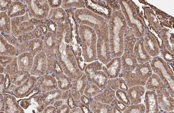 beta Tubulin 2C antibody [C1C3] detects beta Tubulin 2C protein at cytoplasm by immunohistochemical analysis.Sample: Paraffin-embedded mouse kidney.beta Tubulin 2C stained by beta Tubulin 2C antibody [C1C3] (NBP2-14886) diluted at 1:500.Antigen Retrieval: Citrate buffer, pH 6.0, 15 min 