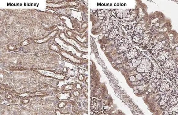 beta Tubulin 2C antibody [C1C3] detects beta Tubulin 2C protein by immunohistochemical analysis.Sample: Paraffin-embedded mouse tissues.beta Tubulin 2C stained by beta Tubulin 2C antibody [C1C3] (NBP2-14886) diluted at 1:500.Antigen Retrieval: Citrate buffer, pH 6.0, 15 min 