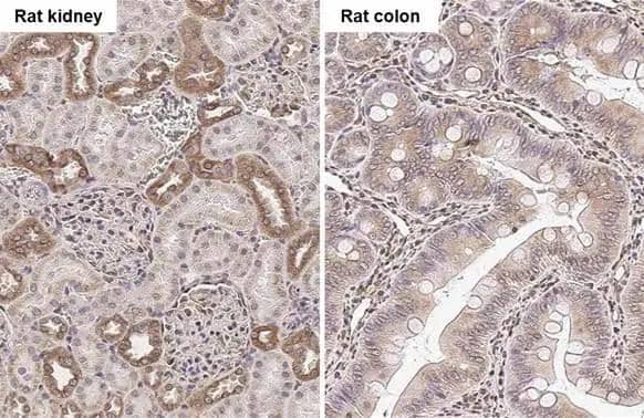 beta Tubulin 2C antibody [C1C3] detects beta Tubulin 2C protein by immunohistochemical analysis.Sample: Paraffin-embedded rat tissues.beta Tubulin 2C stained by beta Tubulin 2C antibody [C1C3] (NBP2-14886) diluted at 1:500.Antigen Retrieval: Citrate buffer, pH 6.0, 15 min 