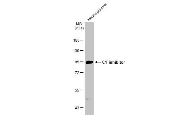 Western Blot: Serpin G1/C1 Inhibitor Antibody [NBP2-14892] - Mouse plasma (50 ug) was separated by 7.5% SDS-PAGE, and the membrane was blotted with Serpin G1/C1 Inhibitor antibody [C1C3] (NBP2-14892) diluted at 1:5000. The HRP-conjugated anti-rabbit IgG antibody  was used to detect the primary antibody.