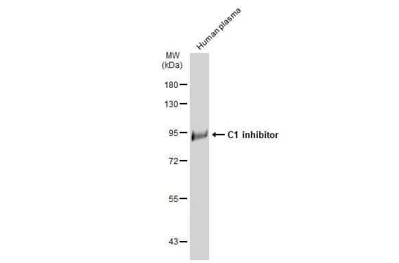 Western Blot: Serpin G1/C1 Inhibitor Antibody [NBP2-14892] - Human plasma (30 ug) was separated by 7.5% SDS-PAGE, and the membrane was blotted with Serpin G1/C1 Inhibitor antibody [C1C3] (NBP2-14892) diluted at 1:5000. The HRP-conjugated anti-rabbit IgG antibody  was used to detect the primary antibody.