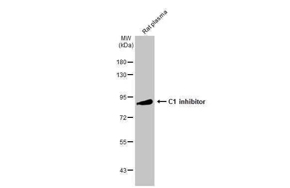 Western Blot: Serpin G1/C1 Inhibitor Antibody [NBP2-14892] - Rat plasma (50 ug) was separated by 7.5% SDS-PAGE, and the membrane was blotted with Serpin G1/C1 Inhibitor antibody [C1C3] (NBP2-14892) diluted at 1:5000. The HRP-conjugated anti-rabbit IgG antibody  was used to detect the primary antibody.