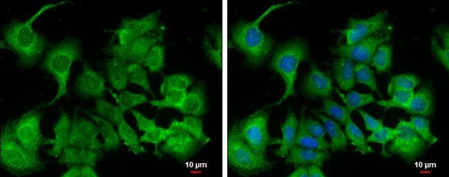 Calpain 9 antibody [N1N3] detects Calpain 9 protein at cytoplasm by immunofluorescent analysis.Sample: MCF7 cells were fixed in 4% paraformaldehyde at RT for 15 min.Green: Calpain 9 protein stained by Calpain 9 antibody [N1N3] (NBP2-14896) diluted at 1:500.Blue: Hoechst 33342 staining.Scale bar = 10 um. 