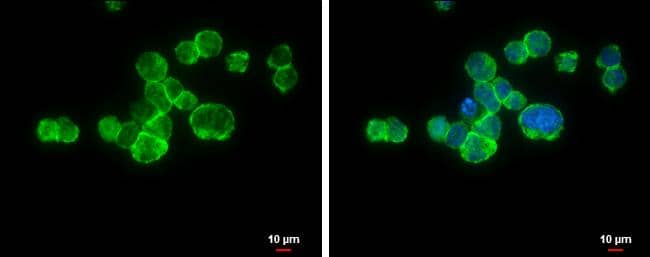 CD11a antibody [N1N3] detects CD11a protein at cell membrane by immunofluorescent analysis.Sample: THP-1 cells were fixed in 4% paraformaldehyde at RT for 15 min.Green: CD11a protein stained by CD11a antibody [N1N3] (NBP2-14902) diluted at 1:500.Blue: Hoechst 33342 staining.Scale bar = 10 um. 