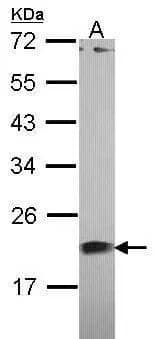 Western Blot Centrin 1 Antibody