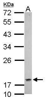 Western Blot: CSRP1 Antibody [NBP2-14919] - Sample (30 ug of whole cell lysate)  A: whole zebrafish  12% SDS PAGE  NBP2-14919 diluted at 1:1000 