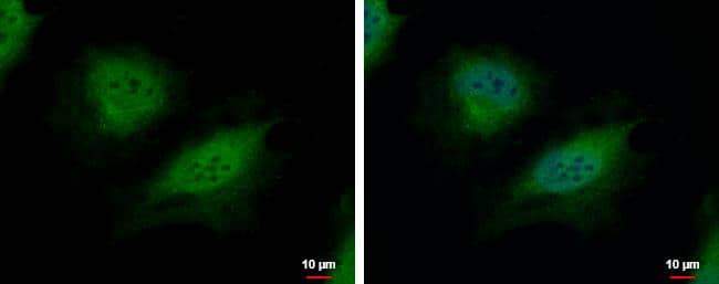 CSRP2BP antibody [N1N3] detects CSRP2BP protein at cytoplasm and nucleus by immunofluorescent analysis.Sample: HeLa cells were fixed in 4% paraformaldehyde at RT for 15 min.Green: CSRP2BP protein stained by CSRP2BP antibody [N1N3] (NBP2-14920) diluted at 1:500.Blue: Hoechst 33342 staining.Scale bar = 10 um. 