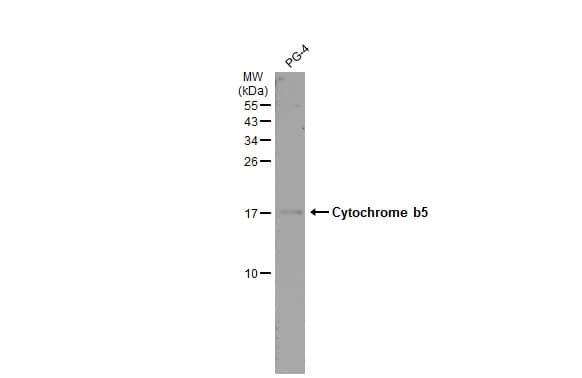 Western Blot: Cytochrome b5 type A Antibody [NBP2-14923] - Whole cell extract (30 ug) was separated by 15% SDS-PAGE, and the membrane was blotted with Cytochrome b5 type A antibody (NBP2-14923) diluted at 1:500. The HRP-conjugated anti-rabbit IgG antibody  was used to detect the primary antibody, and the signal was developed with Trident ECL plus-Enhanced.